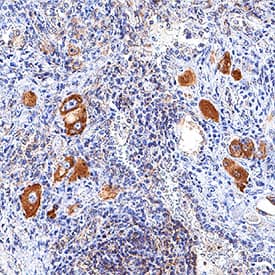 Immunohistochemistry PD-L2/B7-DC/PDCD1LG2 Antibody (176611) [Unconjugated]