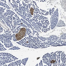 PDX-1/IPF1 was detected in perfusion fixed frozen sections of mouse pancreas using Goat Anti-Mouse/Rat PDX-1/IPF1 Antigen Affinity-purified Polyclonal Antibody (Catalog # AF2517) at 3 µg/mL for 1 hour at room temperature followed by incubation with the Anti-Goat IgG VisUCyte™ HRP Polymer Antibody (Catalog # VC004). Tissue was stained using DAB (brown) and counterstained with hematoxylin (blue). View our protocol for IHC Staining with VisUCyte HRP Polymer Detection Reagents.