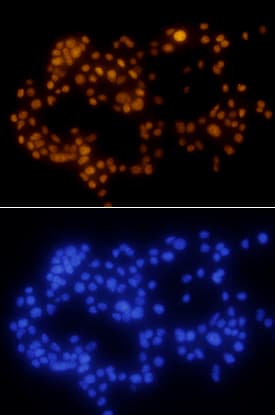PDX-1/IPF1 was detected in immersion fixed  beta TC-6 mouse beta cell insulinoma cell line using Human/Mouse PDX-1/IPF1 Monoclonal Antibody (Catalog # MAB2419) at 10 µg/mL for 3 hours at room temperature. Cells were stained using the NorthernLights™ 557-conjugated Anti-Mouse IgG Secondary Antibody (yellow, upper panel; Catalog # NL007) and counterstained with DAPI (blue, lower panel). View our protocol for Fluorescent ICC Staining of Cells on Coverslips.