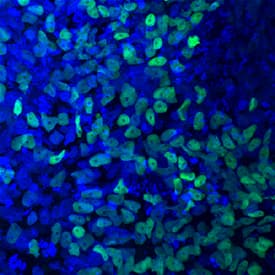 Immunocytochemistry PDX-1/IPF1 Antibody [Unconjugated]