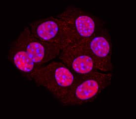 PDX-1/IPF1 was detected in immersion fixed  beta TC-6 mouse beta cell insulinoma cell line using Goat Anti-Mouse/Rat PDX-1/IPF1 Antigen Affinity-purified Polyclonal Antibody (Catalog # AF2517) at 10 µg/mL for 3 hours at room temperature. Cells were stained using the NorthernLights™ 557-conjugated Anti-Goat IgG Secondary Antibody (red; Catalog # NL001) and counterstained with DAPI (blue). Specific staining was localized to the nucleus. View our protocol for Fluorescent ICC Staining of Cells on Coverslips.