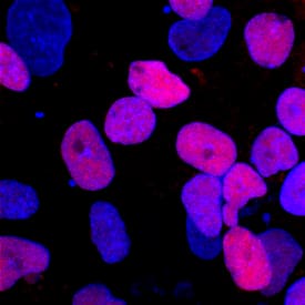 PDX-1/IPF1 was detected in immersion fixed BG01V human embryonic stem cells differentiated to pancreatic progenitor cells using Goat Anti-Human PDX-1/IPF1 Biotinylated Antigen Affinity-purified Polyclonal Antibody (Catalog # BAF2419) at 10 µg/mL for 3 hours at room temperature. Cells were stained using the NorthernLights™ 557-conjugated Streptavidin (red; Catalog # NL999) and counterstained with DAPI (blue). Specific staining was localized to nuclei. View our protocol for Fluorescent ICC Staining of Cells on Coverslips.