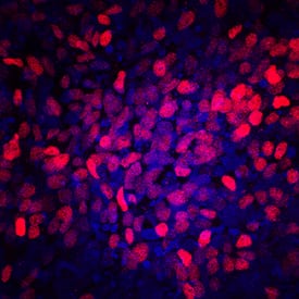 PDX-1/IPF1 was detected in immersion fixed BG01V human embryonic stem cells differentiated into pancreatic progenitor cells using Mouse Anti-Human/Mouse PDX-1/IPF1 Monoclonal Antibody (Catalog # MAB2419) at 10 µg/mL for 3 hours at room temperature. Cells were stained using the NorthernLights™ 557-conjugated Anti-Mouse IgG Secondary Antibody (red; Catalog # NL007) and counterstained with DAPI (blue). Specific staining was localized to nuclei. View our protocol for Fluorescent ICC Staining of Stem Cells on Coverslips.