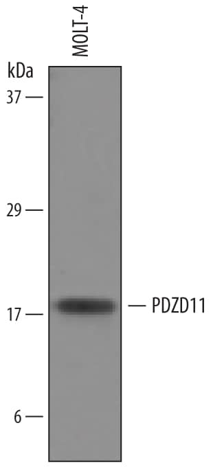 Western Blot PDZD11 Antibody
