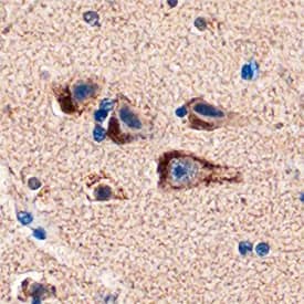 PEA-15 was detected in immersion fixed paraffin-embedded sections of human brain (cortex) using Sheep Anti-Human/Mouse PEA-15 Antigen Affinity-purified Polyclonal Antibody (Catalog # AF5588) at 1 µg/mL overnight at 4 °C. Tissue was stained using the Anti-Sheep HRP-DAB Cell & Tissue Staining Kit (brown; Catalog # CTS019) and counterstained with hematoxylin (blue). Specific staining was localized to neurons. View our protocol for Chromogenic IHC Staining of Paraffin-embedded Tissue Sections.