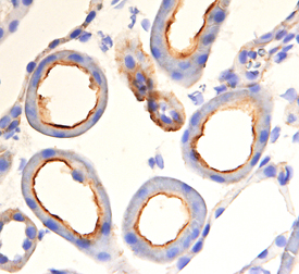 Immunohistochemistry PEDFR/PNPLA2/ATGL Antibody [Unconjugated]