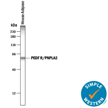 Simple Western lane view shows lysates of mouse adipose tissue, loaded at 0.2 mg/mL. A specific band was detected for PEDF R/PNPLA2 at approximately 59 kDa (as indicated) using 10 µg/mL of Sheep Anti-Human/Mouse/Rat PEDF R/PNPLA2 Antigen Affinity-purified Polyclonal Antibody (Catalog # AF5365) followed by 1:50 dilution of HRP-conjugated Anti-Sheep IgG Secondary Antibody (Catalog # HAF016) . This experiment was conducted under reducing conditions and using the 12-230 kDa separation system.