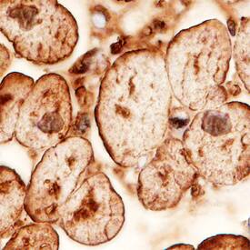 Immunohistochemistry PEDFR/PNPLA2/ATGL Antibody