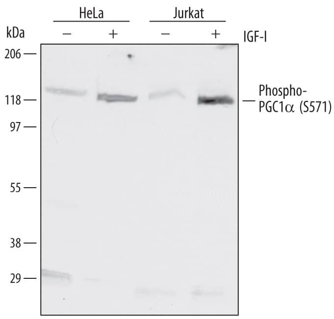Western Blot PGC1 alpha [p Ser571] Antibody [Unconjugated]