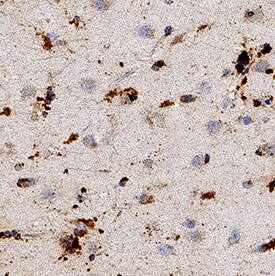 PGD2 Synthase/PTGDS was detected in immersion fixed paraffin-embedded sections of human brain (caudate nucleus) using Mouse Anti-Human/Rat PGD2 Synthase/PTGDS Monoclonal Antibody (Catalog # MAB10099) at 5 µg/mL for 1 hour at room temperature followed by incubation with the Anti-Mouse IgG VisUCyte™ HRP Polymer Antibody (Catalog # VC001). Before incubation with the primary antibody, tissue was subjected to heat-induced epitope retrieval using Antigen Retrieval Reagent-Basic (Catalog # CTS013). Tissue was stained using DAB (brown) and counterstained with hematoxylin (blue). Specific staining was localized to cytoplasm and nuclei in neurons. View our protocol for IHC Staining with VisUCyte HRP Polymer Detection Reagents.