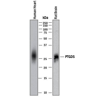 Western blot shows lysates of human heart tissue and rat brain tissue. PVDF membrane was probed with 0.5 µg/mL of Mouse Anti-Human/Rat PGD2 Synthase/PTGDS Monoclonal Antibody (Catalog # MAB10099) followed by HRP-conjugated Anti-Mouse IgG Secondary Antibody (Catalog # HAF018). A specific band was detected for PGD2 Synthase/PTGDS at approximately 26 kDa (as indicated). This experiment was conducted under reducing conditions and using Immunoblot Buffer Group 1.