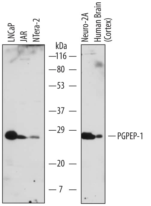 Western Blot PGPEP-1 Antibody