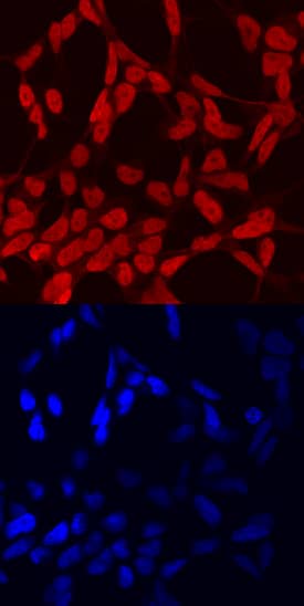Immunocytochemistry PHOX2B Antibody [Unconjugated]