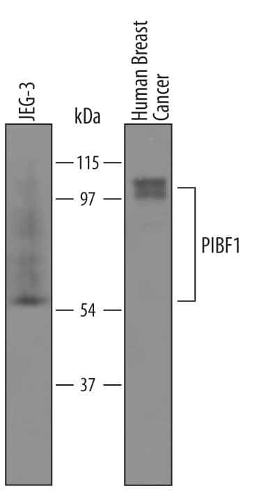 Western blot shows lysates of JEG-3 human epithelial choriocarcinoma cell line and human breast cancer tissue. PVDF membrane was probed with 1 µg/mL of Sheep Anti-Human PIBF1 Antigen Affinity-purified Polyclonal Antibody (Catalog # AF5559) followed by HRP-conjugated Anti-Sheep IgG Secondary Antibody (Catalog # HAF016). Specific bands were detected for PIBF1 at approximately 98 kDa and 55 kDa (as indicated). This experiment was conducted under reducing conditions and using Immunoblot Buffer Group 8.
