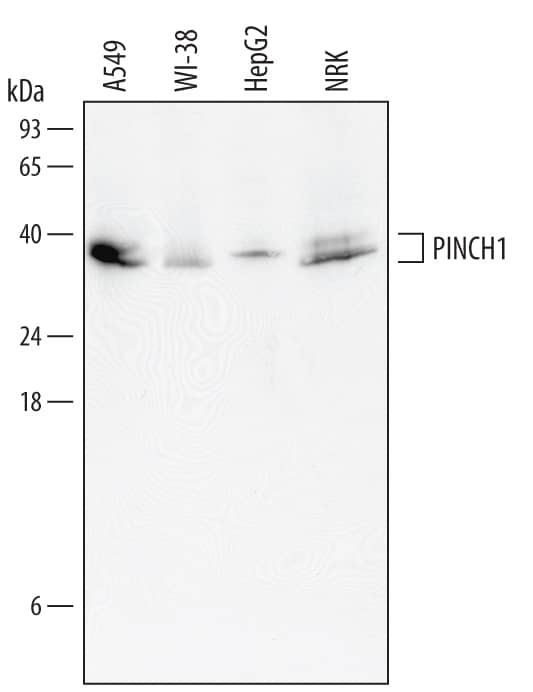 Western Blot PINCH1/LIMS1 Antibody (591604)