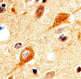 PINK1 was detected in immersion fixed paraffin-embedded sections of human brain (cortex) using 15 µg/mL Rat Anti-Human PINK1 Monoclonal Antibody (Catalog # MAB4357) overnight at 4 °C. Before incubation with the primary antibody tissue was subjected to heat-induced epitope retrieval using Antigen Retrieval Reagent-Basic (Catalog # CTS013). Tissue was stained with the Anti-Rat HRP-DAB Cell & Tissue Staining Kit (brown; Catalog # CTS017) and counterstained with hematoxylin (blue). View our protocol for Chromogenic IHC Staining of Paraffin-embedded Tissue Sections.