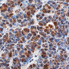 Immunohistochemistry PITX2 Antibody [Unconjugated]