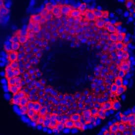 Immunohistochemistry PIWIL1/HIWI Antibody