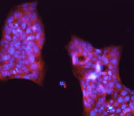 PIWIL1/HIWI was detected in immersion fixed NCI-N87 human gastric carcinoma cell line using Mouse Anti-Human PIWIL1/HIWI Monoclonal Antibody (Catalog # MAB6548) at 10 µg/mL for 3 hours at room temperature. Cells were stained using the NorthernLights™ 557-conjugated Anti-Mouse IgG Secondary Antibody (red; Catalog # NL007) and counterstained with DAPI (blue). Specific staining was localized to the cytoplasm in colonies of NCI-N87 cells. View our protocol for Fluorescent ICC Staining of Cells on Coverslips.