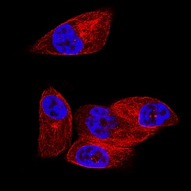 PKA RIIa was detected in immersion fixed MDA-MB-231 human breast cancer cell line using Rabbit Anti-Human/Mouse PKA RIIa Monoclonal Antibody (Catalog # MAB8000) at 8 µg/mL for 3 hours at room temperature. Cells were stained using the NorthernLights™ 557-conjugated Anti-Mouse IgG Secondary Antibody (red; Catalog # NL007) and counterstained with DAPI (blue). Specific staining was localized to cytoplasm. View our protocol for Fluorescent ICC Staining of Cells on Coverslips.
