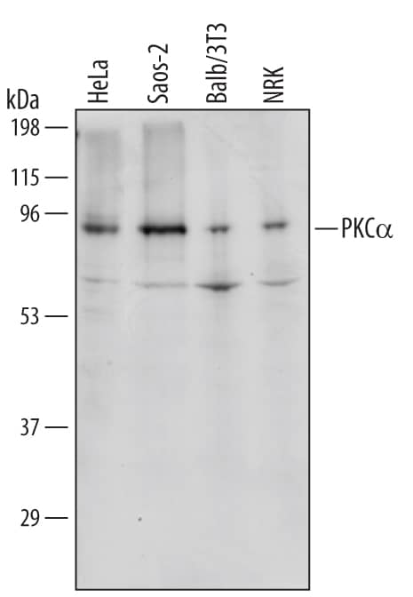 Western blot shows lysates of HeLa human cervical epithelial carcinoma cell line, Saos-2 human osteosarcoma cell line, Balb/3T3 mouse embryonic fibroblast cell line, and NRK rat normal kidney cell line. PVDF membrane was probed with 1 µg/mL of Human/Mouse/Rat PKCa Antigen Affinity-purified Polyclonal Antibody (Catalog # AF5340) followed by HRP-conjugated Anti-Goat IgG Secondary Antibody (Catalog # HAF109). A specific band was detected for PKCa at approximately 90 kDa (as indicated). This experiment was conducted under reducing conditions and using Immunoblot Buffer Group 1.