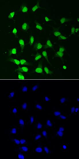 PKC beta 1 was detected in immersion fixed rat cortical stem cells using Goat Anti-Human/Rat PKC beta 1 Antigen Affinity-purified Polyclonal Antibody (Catalog # AF3759) at 10 µg/mL for 3 hours at room temperature. Cells were stained using the NorthernLights™ 493-conjugated Anti-Goat IgG Secondary Antibody (green, upper panel; Catalog # NL003) and counterstained with DAPI (blue, lower panel). View our protocol for Fluorescent ICC Staining of Cells on Coverslips.