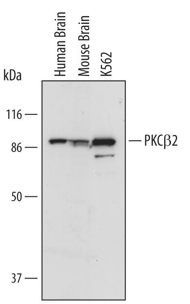 Western blot shows lysates of human brain tissue, mouse brain tissue, and K562 human chronic myelogenous leukemia cell line. PVDF membrane was probed with 1 µg/mL of Human/Mouse PKC beta 2 Antigen Affinity-purified Polyclonal Antibody (Catalog # AF4378) followed by HRP-conjugated Anti-Sheep IgG Secondary Antibody (Catalog # HAF016). A specific band was detected for PKC beta 2 at approximately 90 kDa (as indicated). This experiment was conducted under reducing conditions and using Immunoblot Buffer Group 1.