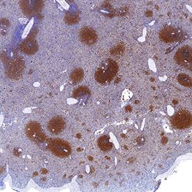 PKC beta 2 was detected in immersion fixed paraffin-embedded sections of human spleen using Mouse Anti-Human/Mouse PKC beta 2 Monoclonal Antibody (Catalog # MAB43781) at 5 µg/mL for 1 hour at room temperature followed by incubation with the Anti-Mouse/Rabbit IgG VisUCyte™ HRP Polymer Antibody (Catalog # VC002). Tissue was stained using DAB (brown) and counterstained with hematoxylin (blue). Specific staining was localized to cytoplasm in splenocytes. View our protocol for IHC Staining with VisUCyte HRP Polymer Detection Reagents.