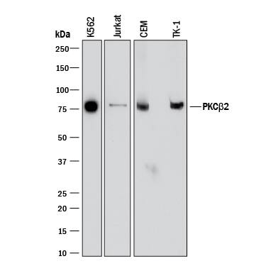 Western blot shows lysates of K562 human chronic myelogenous leukemia cell line, Jurkat human acute T cell leukemia cell line, CEM human T-lymphoblastoid cell line, and TK-1 mouse T cell lymphoma cell line. PVDF membrane was probed with 1 µg/mL of Mouse Anti-Human/Mouse PKC beta 2 Monoclonal Antibody (Catalog # MAB43781) followed by HRP-conjugated Anti-Mouse IgG Secondary Antibody (Catalog # HAF018). A specific band was detected for PKC beta 2 at approximately 80 kDa (as indicated). This experiment was conducted under reducing conditions and using Immunoblot Buffer Group 1.