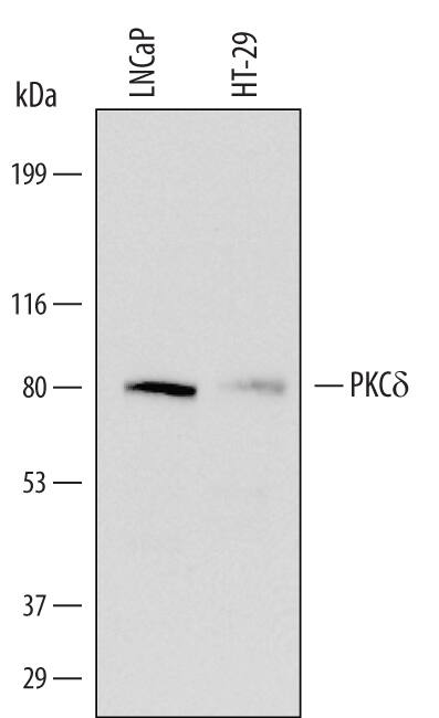 Western blot shows lysates of LNCaP human prostate cancer cell line and HT-29 human colon adenocarcinoma cell line. PVDF Membrane was probed with 1 µg/mL of Sheep Anti-Human PKCd Antigen Affinity-purified Polyclonal Antibody (Catalog # AF4585) followed by HRP-conjugated Anti-Sheep IgG Secondary Antibody (Catalog # HAF016). A specific band was detected for PKCd at approximately 78 kDa (as indicated). This experiment was conducted under reducing conditions and using Immunoblot Buffer Group 2.