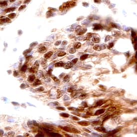 Immunohistochemistry PKC epsilon Antibody [Unconjugated]