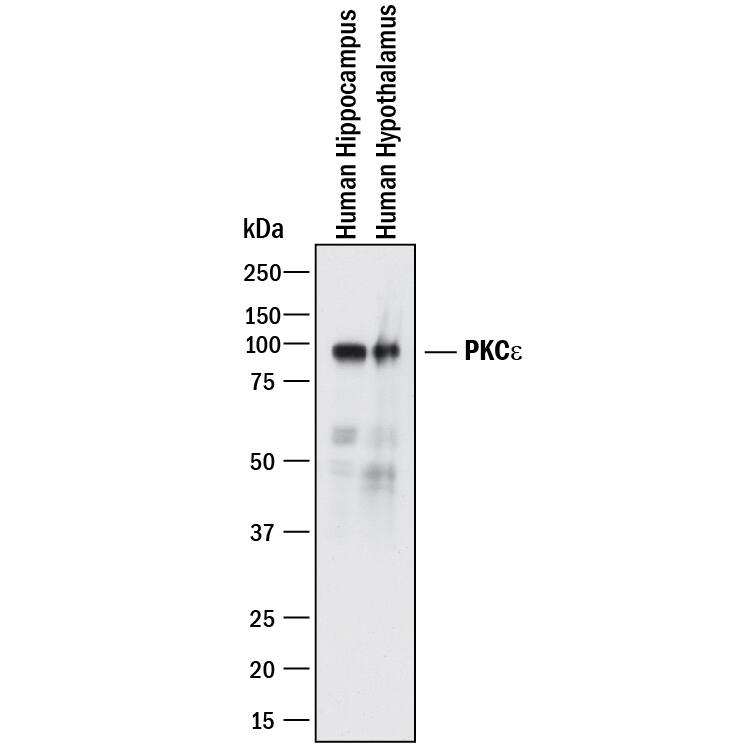 Western blot shows lysates of Human brain (hippocampus) tissue and human brain (hypothalamus) tissue. PVDF membrane was probed with 2 µg/mL of Mouse Anti-Human PKCe Monoclonal Antibody (Catalog # MAB51341) followed by HRP-conjugated Anti-Mouse IgG Secondary Antibody (Catalog # HAF018). A specific band was detected for PKCe at approximately 90 kDa (as indicated). This experiment was conducted under reducing conditions and using Immunoblot Buffer Group 1.