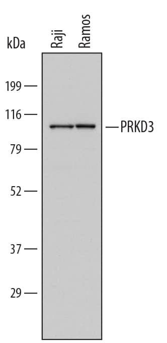 Western blot shows lysates of Raji human Burkitt's lymphoma cell line and Ramos human Burkitt's lymphoma cell line. PVDF Membrane was probed with 1 µg/mL of Sheep Anti-Human PRKD3/nPKC nu Antigen Affinity-purified Polyclonal Antibody (Catalog # AF6478) followed by HRP-conjugated Anti-Sheep IgG Secondary Antibody (Catalog # HAF016). A specific band was detected for PRKD3/nPKC nu at approximately 105 kDa (as indicated). This experiment was conducted under reducing conditions and using Immunoblot Buffer Group 1.