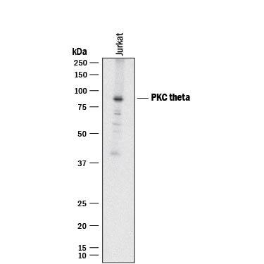 Western blot shows lysates of Jurkat human acute T cell leukemia cell line. PVDF membrane was probed with 1 µg/mL of Human/Mouse PKC theta Antigen Affinity-purified Polyclonal Antibody (Catalog # AF4368) followed by HRP-conjugated Anti-Sheep IgG Secondary Antibody (Catalog # HAF016). A specific band was detected for PKC theta at approximately 82 kDa (as indicated). This experiment was conducted under reducing conditions and using Immunoblot Buffer Group 1.