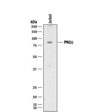 Western Blot PKC theta Antibody (453416) [Unconjugated]