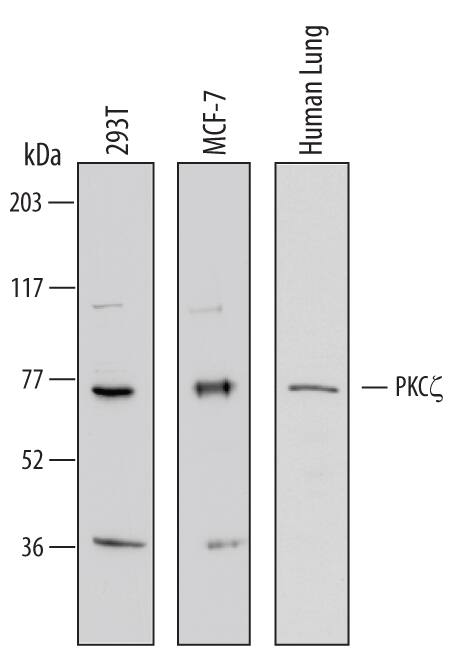 Western blot shows lysates of 293T human embryonic kidney cell line, MCF-7 human breast cancer cell line, and human lung tissue. PVDF Membrane was probed with 1 µg/mL of Human PKC zeta Antigen Affinity-purified Polyclonal Antibody (Catalog # AF6666) followed by HRP-conjugated Anti-Sheep IgG Secondary Antibody (Catalog # HAF016). A specific band was detected for PKC zeta at approximately 75 kDa (as indicated). This experiment was conducted under reducing conditions and using Immunoblot Buffer Group 1.