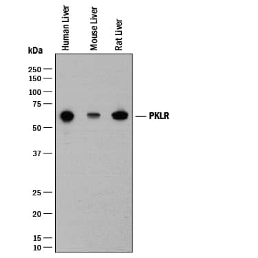 Western Blot PKLR Antibody [Unconjugated]