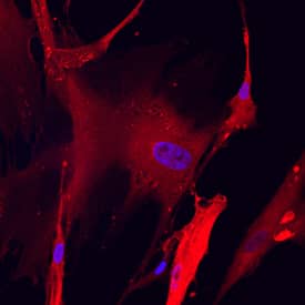 PKM2 was detected in immersion fixed Wi-38 human lung fibroblast cell line using Sheep Anti-Human/Mouse/Rat PKM1/2 Antigen Affinity-purified Polyclonal Antibody (Catalog # AF7244) at 10 µg/mL for 3 hours at room temperature. Cells were stained using the NorthernLights™ 557-conjugated Anti-Sheep IgG Secondary Antibody (red; NL010) and counterstained with DAPI (blue). Specific staining was localized to cytoplasm. View our protocol for Fluorescent ICC Staining of Cells on Coverslips.