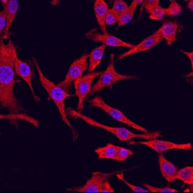 PKM2 was detected in immersion fixed RAW 264.7 mouse monocyte/macrophage cell line using Sheep Anti-Human/Mouse/Rat PKM1/2 Antigen Affinity-purified Polyclonal Antibody (Catalog # AF7244) at 10 µg/mL for 3 hours at room temperature. Cells were stained using the NorthernLights™ 557-conjugated Anti-Sheep IgG Secondary Antibody (red; NL010) and counterstained with DAPI (blue). Specific staining was localized to cytoplasm. View our protocol for Fluorescent ICC Staining of Cells on Coverslips.