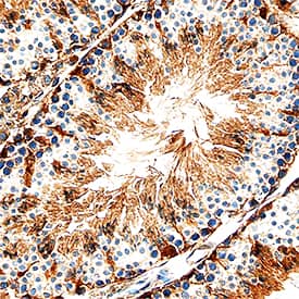 PKM2 was detected in perfusion fixed frozen sections of mouse testis using Sheep Anti-Human/Mouse/Rat PKM1/2 Antigen Affinity-purified Polyclonal Antibody (Catalog # AF7244) at 1.7 µg/mL overnight at 4 °C. Tissue was stained using the Anti-Sheep HRP-DAB Cell & Tissue Staining Kit (brown; CTS019) and counterstained with hematoxylin (blue). Specific staining was localized to Sertoli cells in testis. View our protocol for Chromogenic IHC Staining of Frozen Tissue Sections.