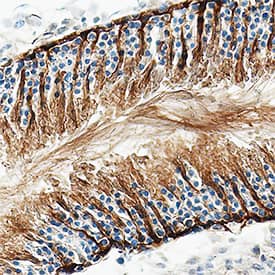PKM2 was detected in perfusion fixed frozen sections of rat testis using Sheep Anti-Human/Mouse/Rat PKM1/2 Antigen Affinity-purified Polyclonal Antibody (Catalog # AF7244) at 1.7 µg/mL overnight at 4 °C. Tissue was stained using the Anti-Sheep HRP-DAB Cell & Tissue Staining Kit (brown; Catalog # CTS019) and counterstained with hematoxylin (blue). Specific staining was localized to Sertoli cells in testis. View our protocol for Chromogenic IHC Staining of Frozen Tissue Sections.