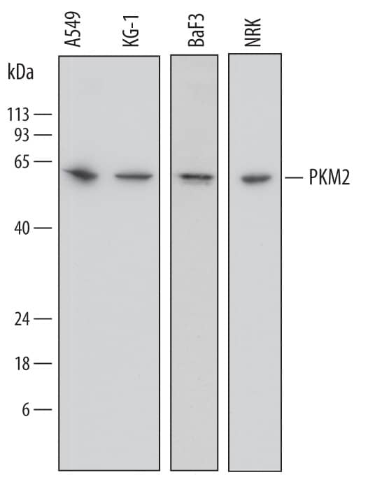 Western blot shows lysates of A549 human lung carcinoma cell line, KG-1 human acute myelogenous leukemia cell line, BaF3 mouse pro-B cell line, and NRK rat normal kidney cell line. PVDF membrane was probed with 0.2 µg/mL of Sheep Anti-Human/Mouse/Rat PKM1/2 Antigen Affinity-purified Polyclonal Antibody (Catalog # AF7244) followed by HRP-conjugated Anti-Sheep IgG Secondary Antibody (HAF016). A specific band was detected for PKM2 at approximately 60 kDa (as indicated). This experiment was conducted under reducing conditions and using Immunoblot Buffer Group 1.