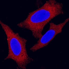 PKM2 was detected in immersion fixed HeLa human cervical epithelial carcinoma cell line using Mouse Anti-Human PKM1/2 Monoclonal Antibody (Catalog # MAB72443) at 25 µg/mL for 3 hours at room temperature. Cells were stained using the NorthernLights™ 557-conjugated Anti-Mouse IgG Secondary Antibody (red; NL007) and counterstained with DAPI (blue). Specific staining was localized to cytoplasm. View our protocol for Fluorescent ICC Staining of Cells on Coverslips.