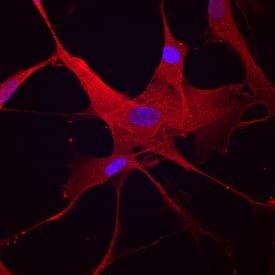 PKM2 was detected in immersion fixed WI-38 human lung fibroblast cell line using Mouse Anti-Human/Rat PKM1/2 Monoclonal Antibody (Catalog # MAB7244) at 10 µg/mL for 3 hours at room temperature. Cells were stained using the NorthernLights™ 557-conjugated Anti-Mouse IgG Secondary Antibody (red; NL007) and counterstained with DAPI (blue). Specific staining was localized to cytoplasm. View our protocol for Fluorescent ICC Staining of Cells on Coverslips.