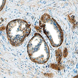PKM2 was detected in immersion fixed paraffin-embedded sections of human prostate using Mouse Anti-Human/Rat PKM1/2 Monoclonal Antibody (Catalog # MAB7244) at 1 µg/mL overnight at 4 °C. Tissue was stained using the Anti-Mouse HRP-DAB Cell & Tissue Staining Kit (brown; CTS002) and counterstained with hematoxylin (blue). Specific staining was localized to epithelial cell cytoplasm. View our protocol for Chromogenic IHC Staining of Paraffin-embedded Tissue Sections.