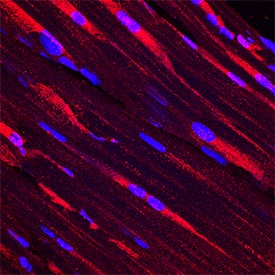 PKM2 was detected in perfusion fixed frozen sections of rat skeletal muscle using Mouse Anti-Human/Rat PKM1/2 Monoclonal Antibody (Catalog # MAB7244) at 8 µg/mL overnight at 4 °C. Tissue was stained using the NorthernLights™ 557-conjugated Anti-Mouse IgG Secondary Antibody (red; NL007) and counterstained with DAPI (blue). Specific staining was localized to epithelial cell cytoplasm. View our protocol for Fluorescent IHC Staining of Frozen Tissue Sections.