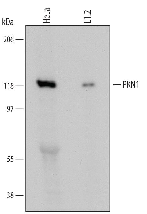 Western blot shows lysates of HeLa human cervical epithelial carcinoma cell line and L1.2 mouse pro-B cell line. PVDF Membrane was probed with 1 µg/mL of Mouse Anti-Human/Mouse PKN1 Monoclonal Antibody (Catalog # MAB6100) followed by HRP-conjugated Anti-Mouse IgG Secondary Antibody (Catalog # HAF007). A specific band was detected for PKN1 at approximately 120 kDa (as indicated). This experiment was conducted under reducing conditions and using Immunoblot Buffer Group 1.