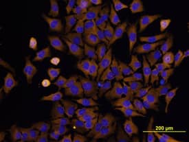 Immunocytochemistry PKR Antibody (HL71/10) [Unconjugated]