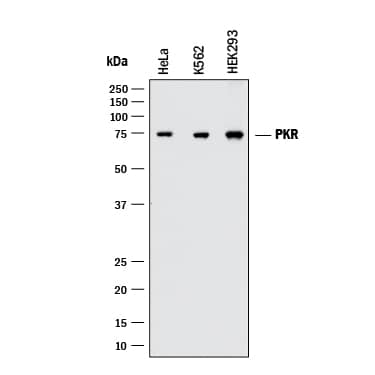 Western Blot PKR Antibody (HL71/10) [Unconjugated]