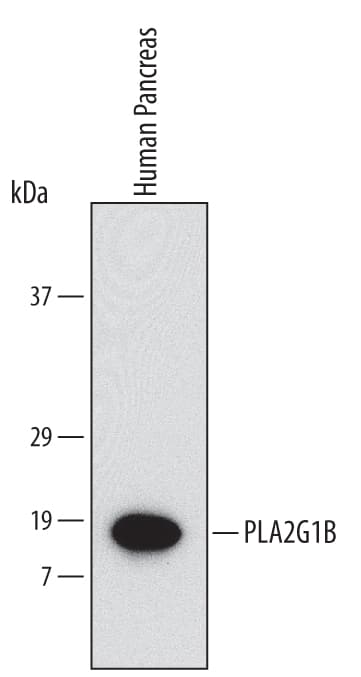 Western blot shows lysates of human pancreas tissue. PVDF Membrane was probed with 2 µg/mL of Human PLA2G1B Monoclonal Antibody (Catalog # MAB5018) followed by HRP-conjugated Anti-Mouse IgG Secondary Antibody (Catalog # HAF007). A specific band was detected for PLA2G1B at approximately 17 kDa (as indicated). This experiment was conducted under non-reducing conditions and using Immunoblot Buffer Group 1.